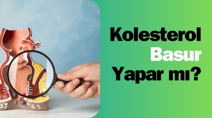 Kolesterol Basur Yapar mı?